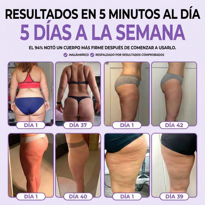 Sistema 4-en-1 Anti-Celulitis